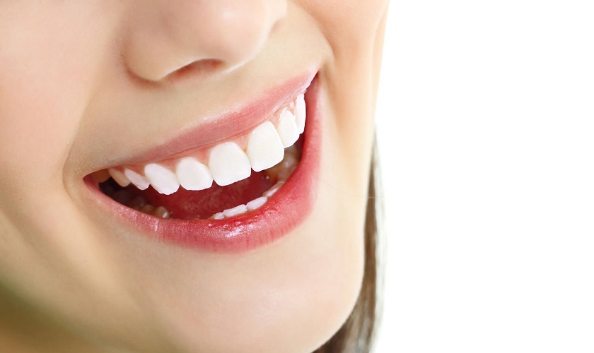 Có nên bọc răng sứ giá rẻ? Những điều bạn cần hiểu trước khi quyết định