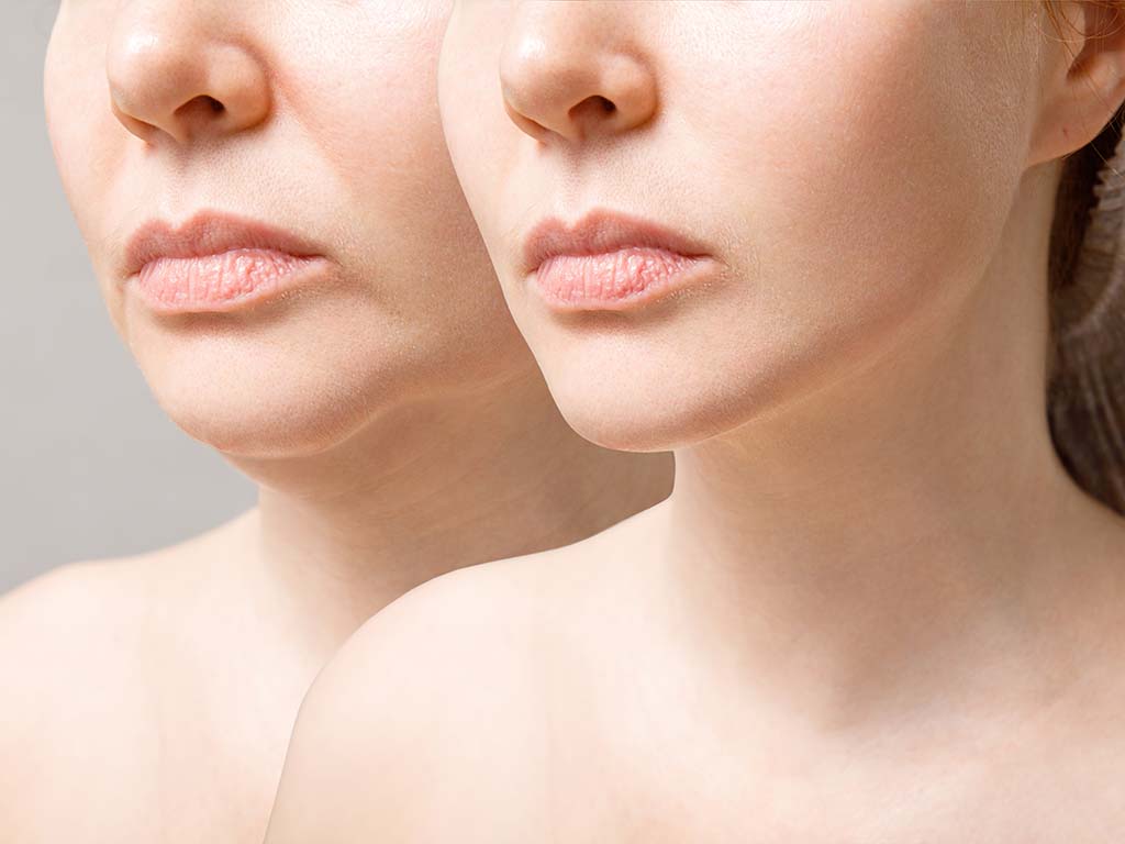 Top 5 Combination Treatments for Total Facial Rejuvenation