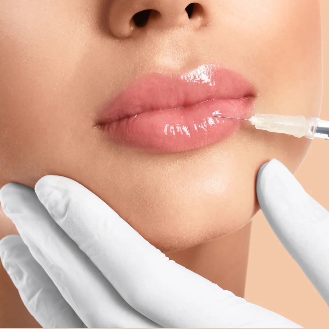 Can Juvederm Fillers Smooth Wrinkles?