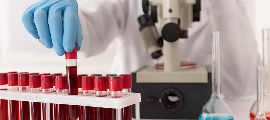 How a Routine CBC in Preventive Check-Ups Can Save You from Major Health Issues