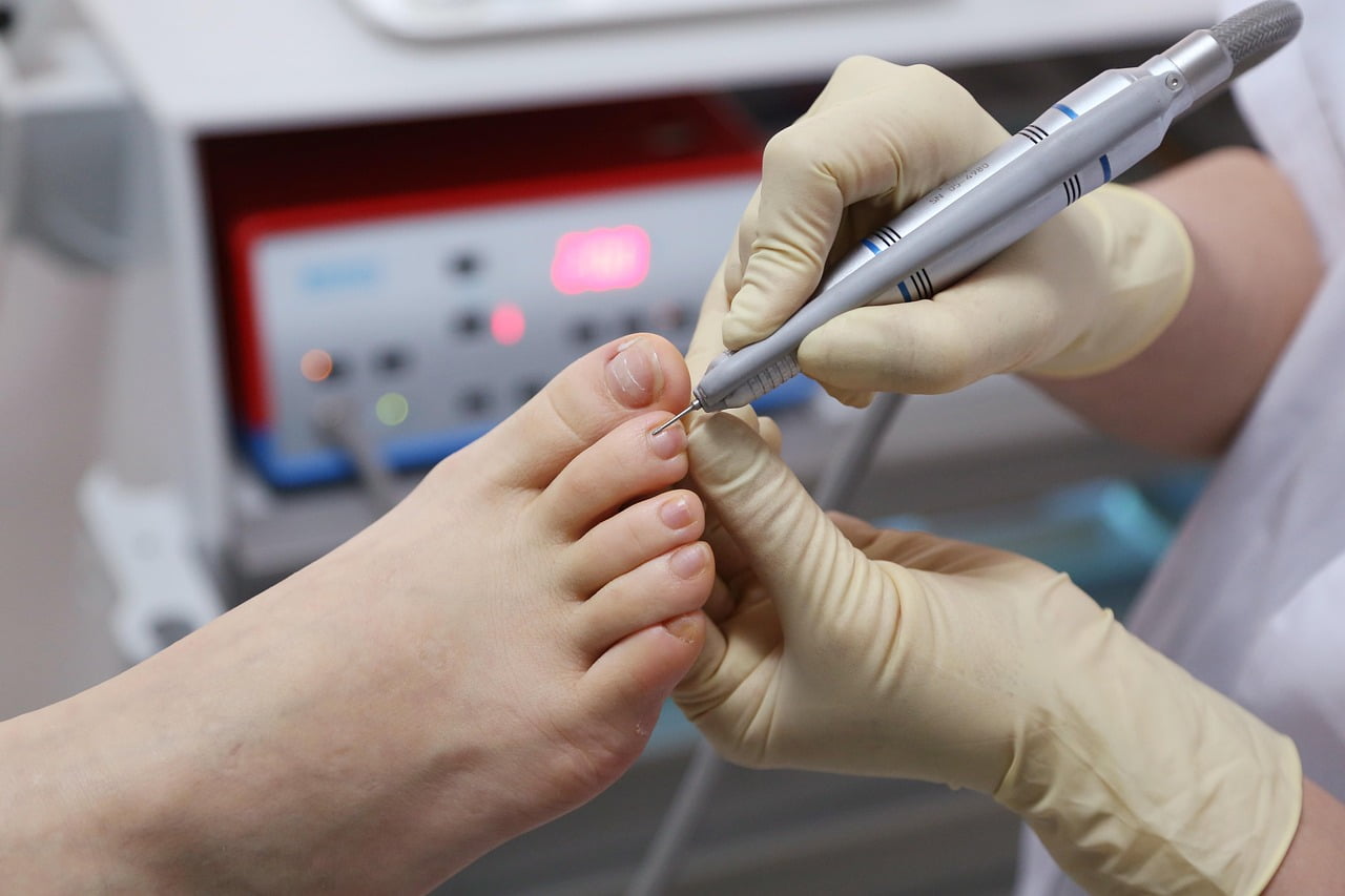 What Does a Podiatrist Doctor Do?