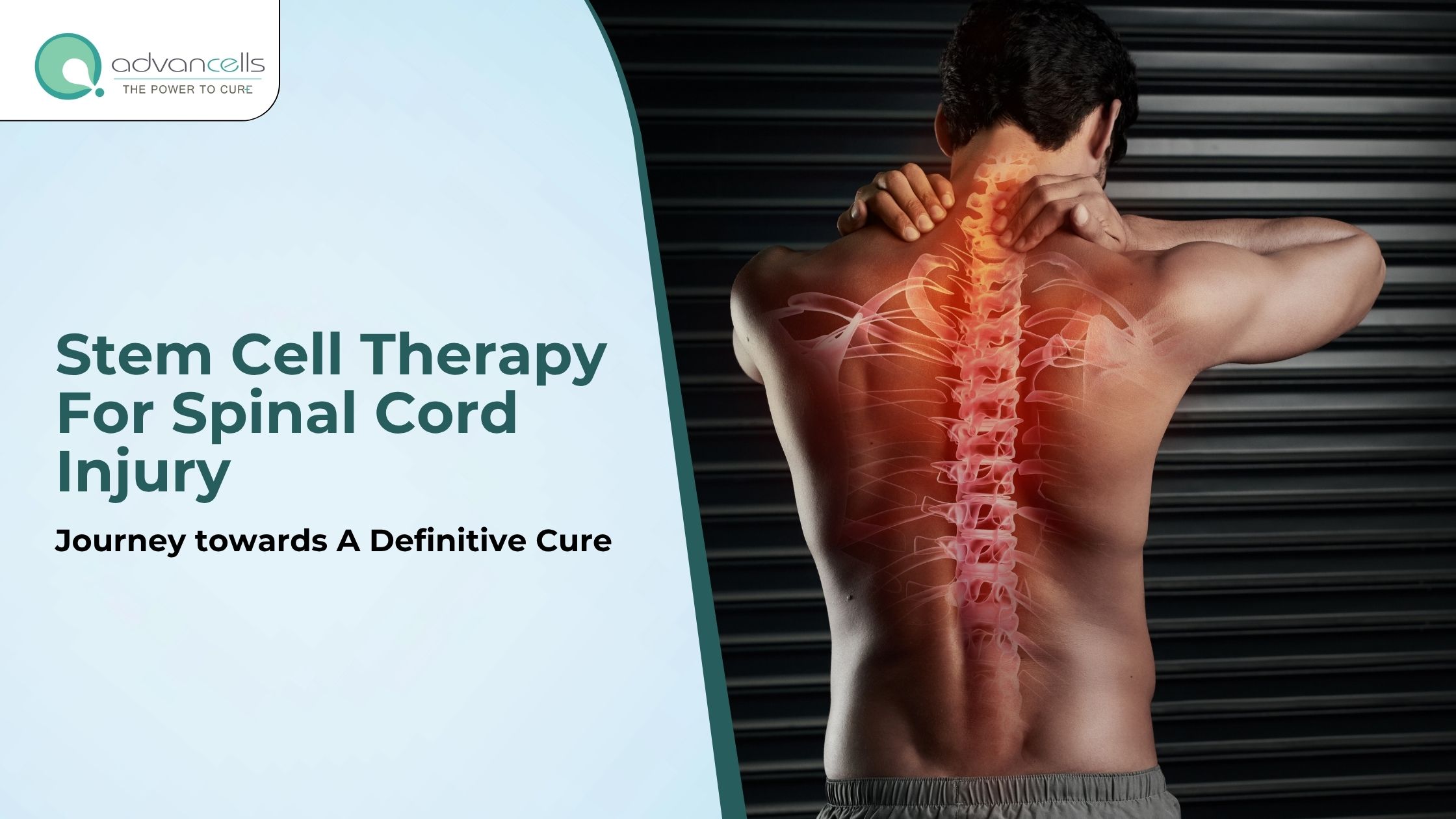 Stem Cell Therapy For Spinal Cord Injury: Journey towards A Definitive Cure