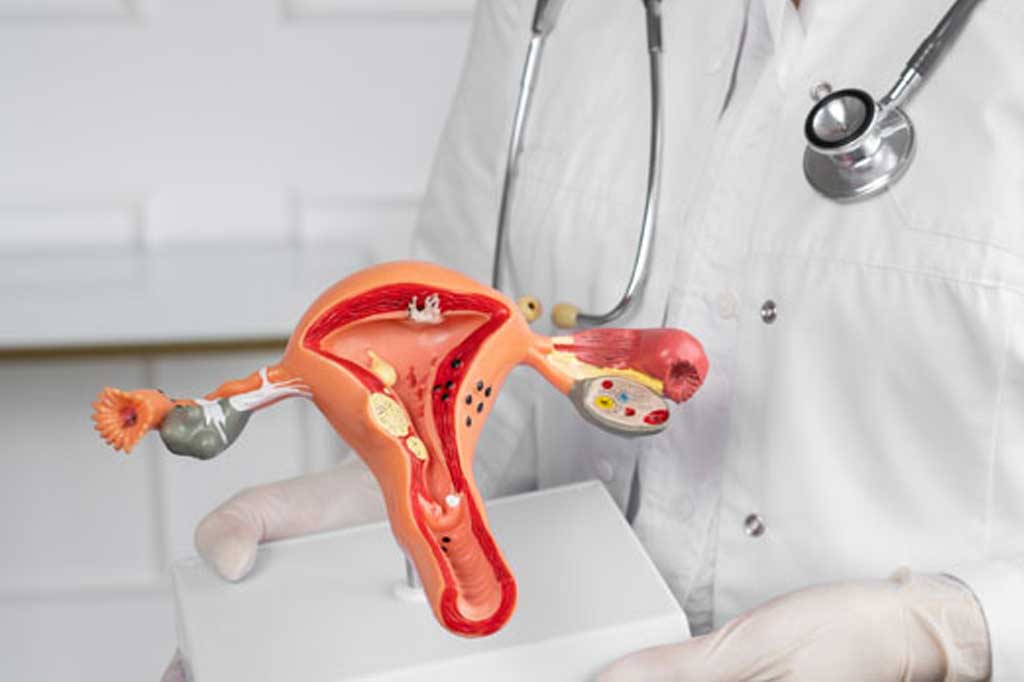 10 Signs You’ve Found the Right Oncologist for Uterus Cancer