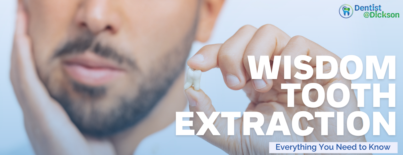 Wisdom Tooth Extraction in Canberra- Everything You Need to Know