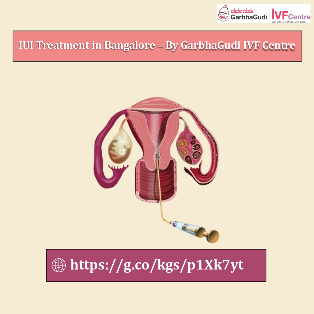 IUI Treatment in Bangalore &ndash; Your Path to Parenthood with GarbhaGudi