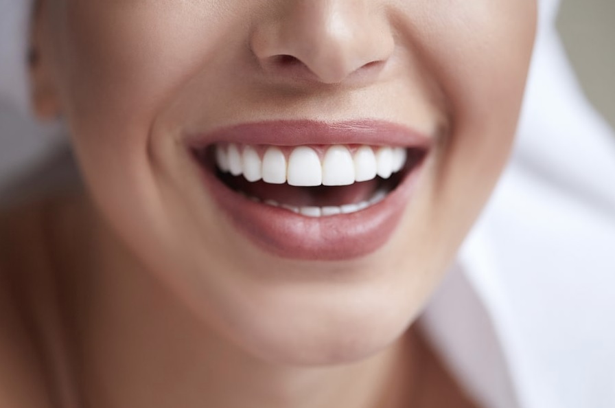 What to Expect from a Cosmetic Dentist in Sydney