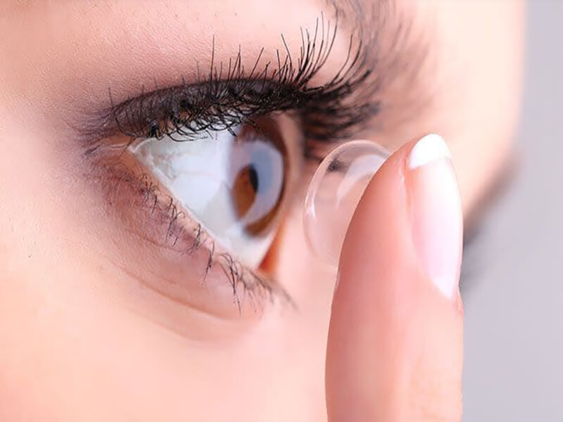 Contact Lenses Market Size Worth USD 14.62 Billion in 2033 | IMARC Group