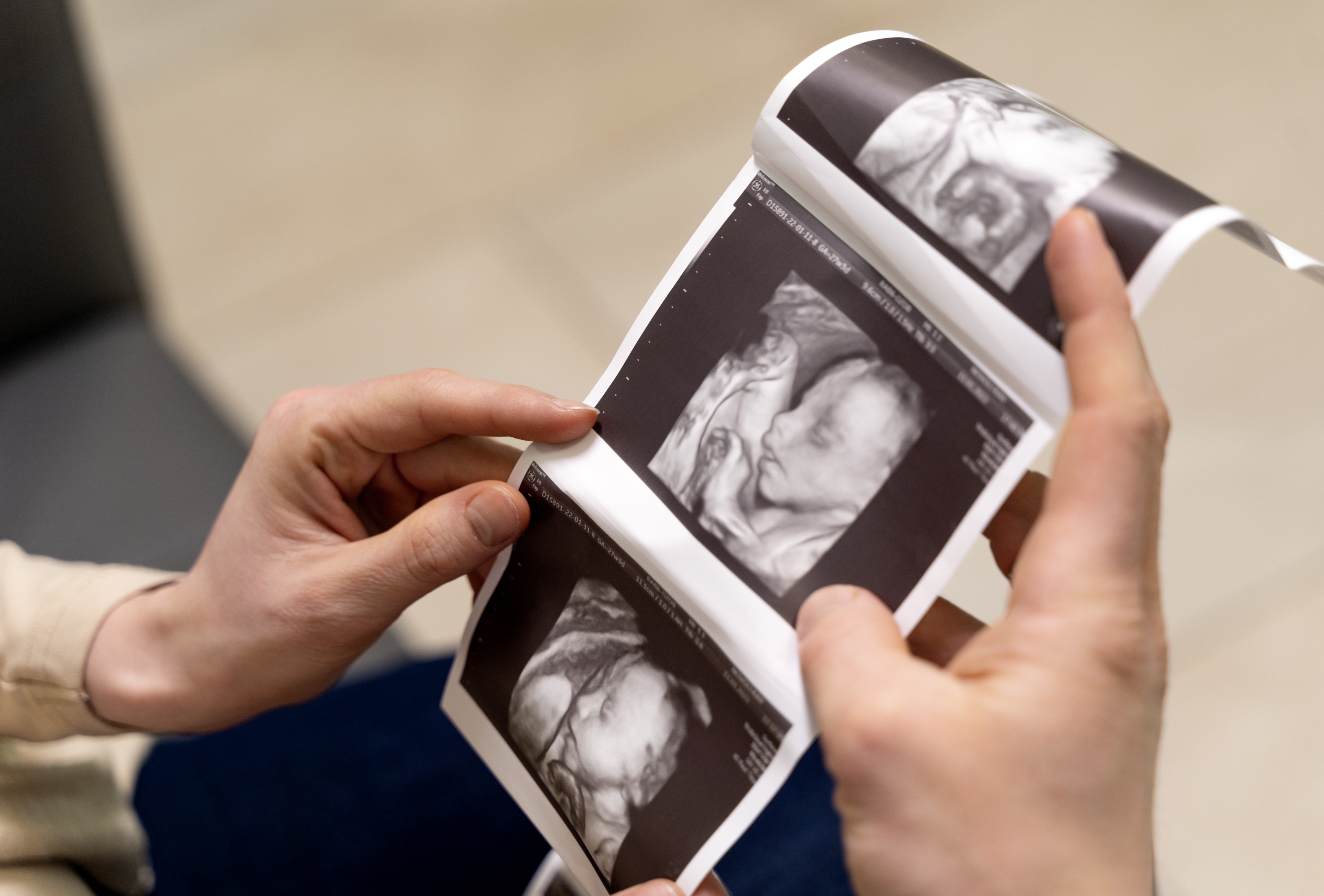 How Accurate Are Gender Scans? Everything You Need to Know