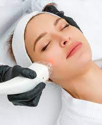 Should I Moisturize After Laser Skin Resurfacing?