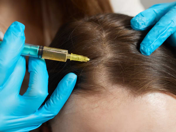 How to Prepare for Best PRP Hair Treatment?