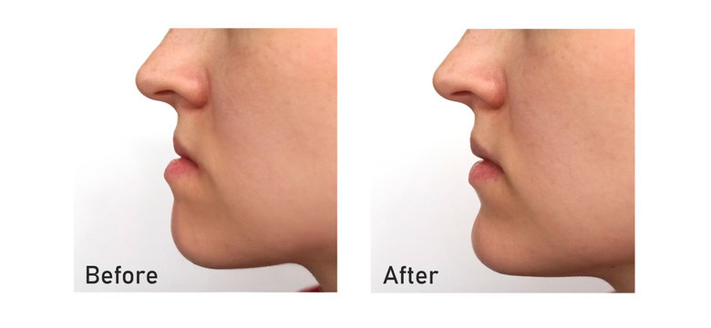 How to Choose the Right Clinic for Jaw Surgery in Islamabad
