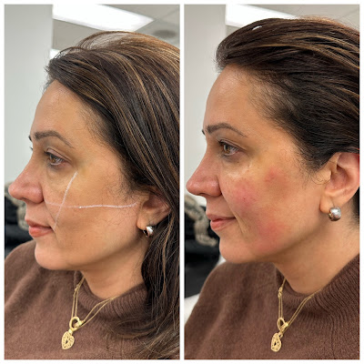 Can A Medical Spa Help You Achieve Long-Term Skin Health?