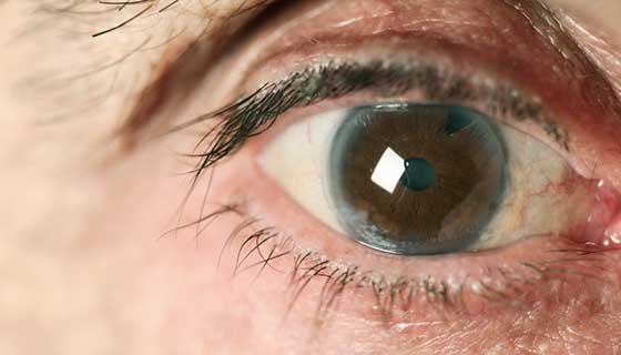 Get Expert Eye Care at Arora Eye Centre, the Best Eye Hospital in Karnal