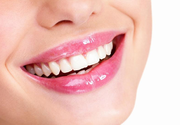 Teeth Whitening: Do You Need a Custom Shade Plan?