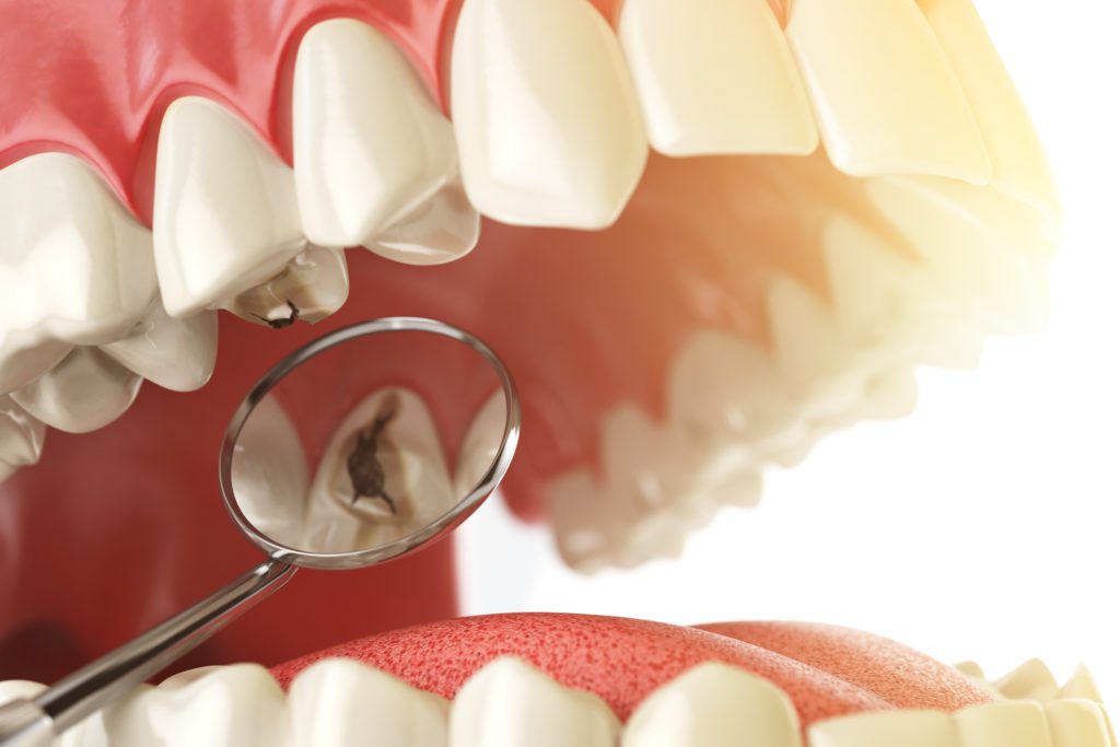 The Importance of Immediate Dental Care in Emergencies