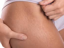 Are Multiple Treatments Required for Full Results?