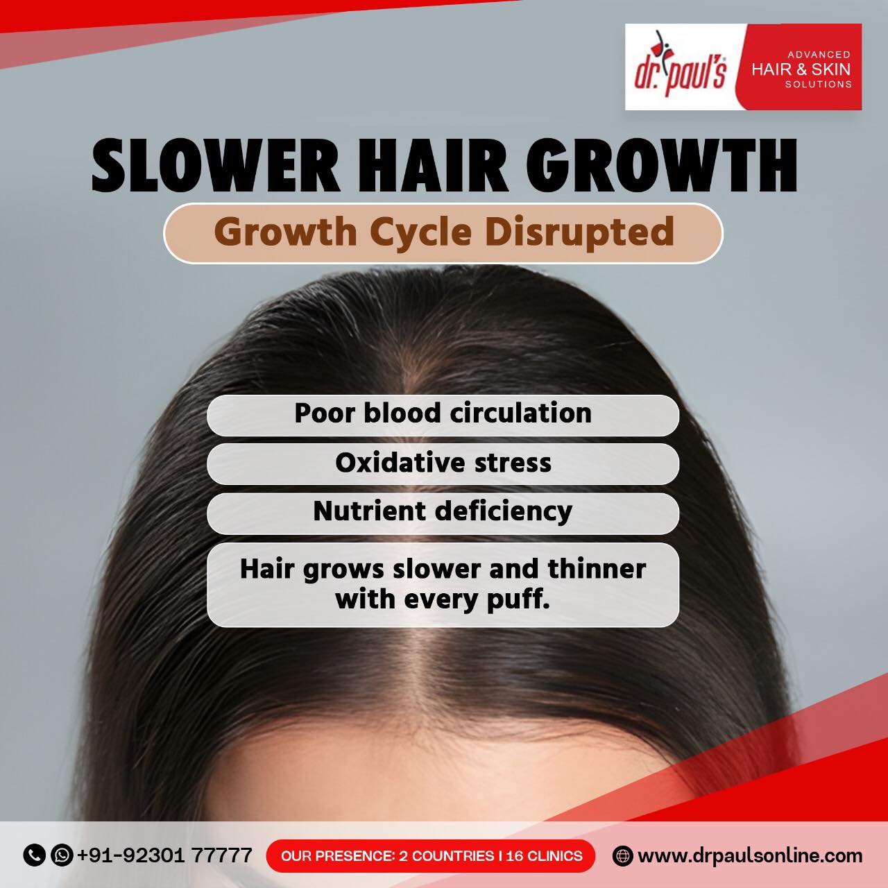 Hair Transplant in Kolkata: Cost, Treatment Options & the Best Clinic to Choose