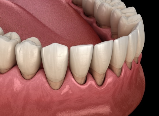 7 Expert Benefits of Periodontist Newark DE