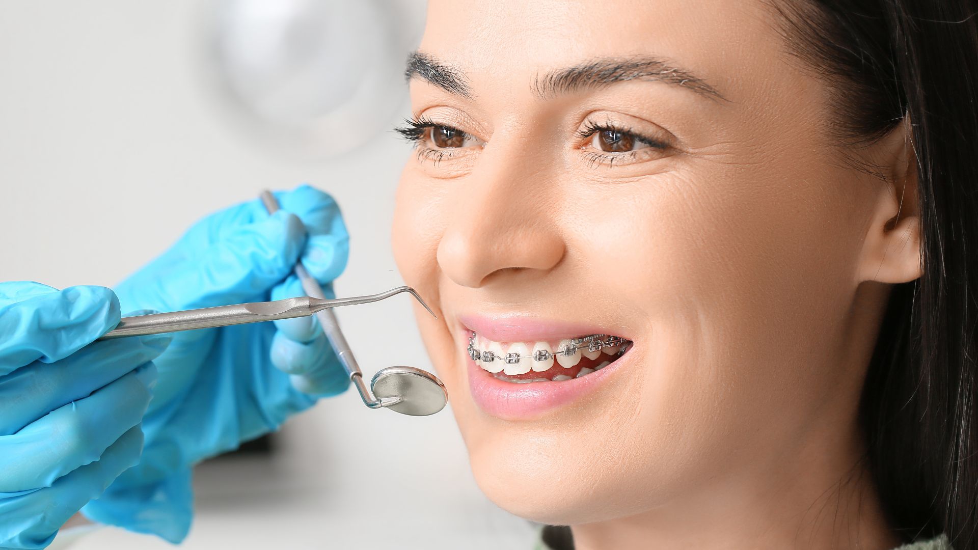 Braces Treatment Explained: Benefits, Process, and Tips