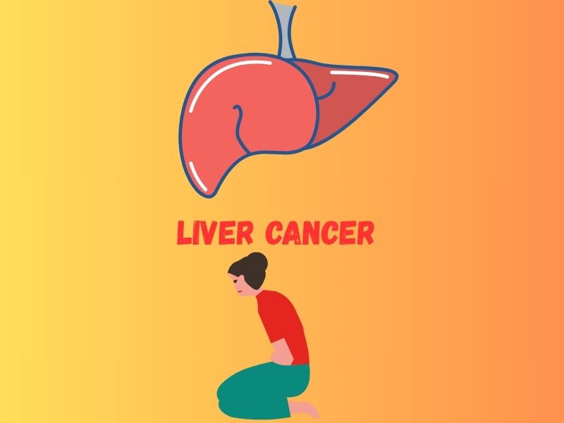 Liver Cancer - Symptoms and prevention