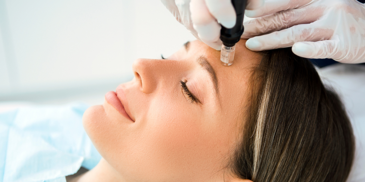 How Dermapen Rejuvenates Tired and Lifeless Skin?