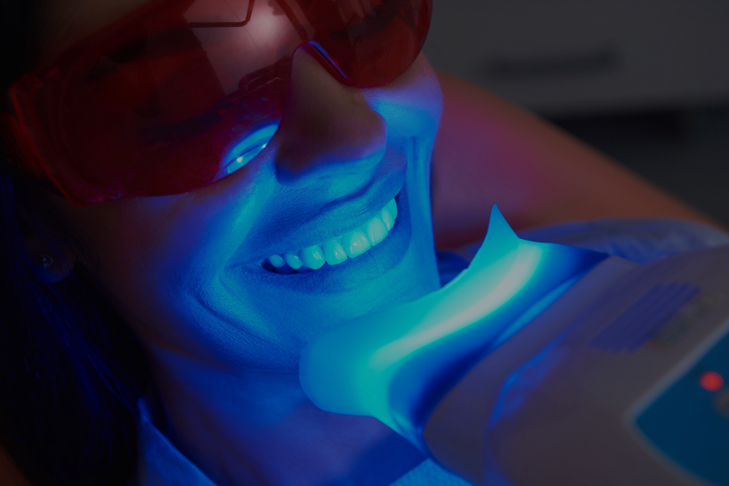 Brampton Teeth Whitening: Brighten Your Smile with Delta Park Dental