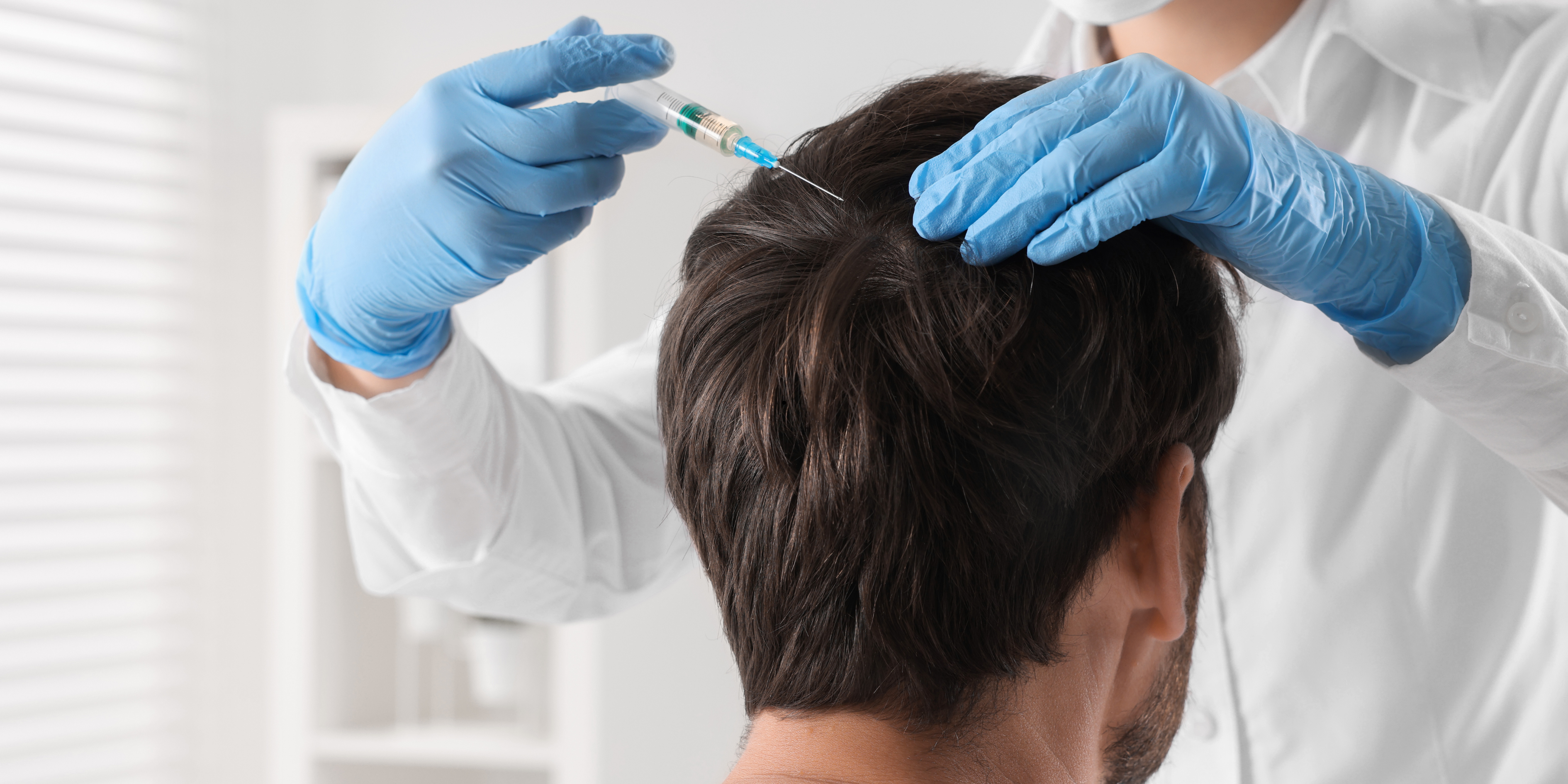 Hair Transplant Surgery in Ireland- What to Expect?