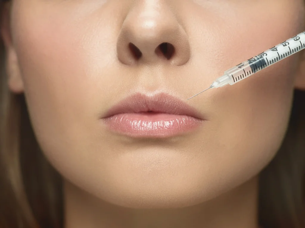 Can Lip Fillers Be Combined with Other Treatments?
