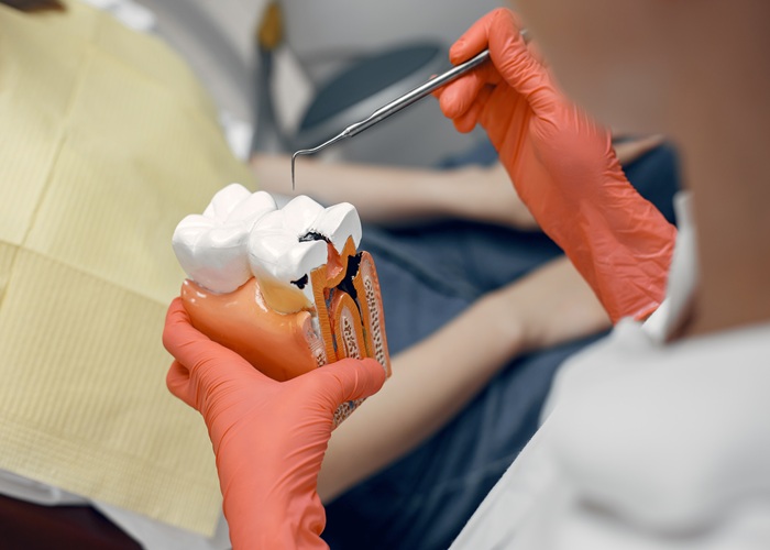 Root Canal Treatment: How It Works and Why You Might Need One