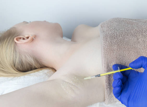 What’s the Right Age for Botox Injections for Sweaty Glands Use?