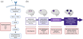 Liquid Vigabatrin: A Practical and Powerful Treatment for Pediatric Epilepsy