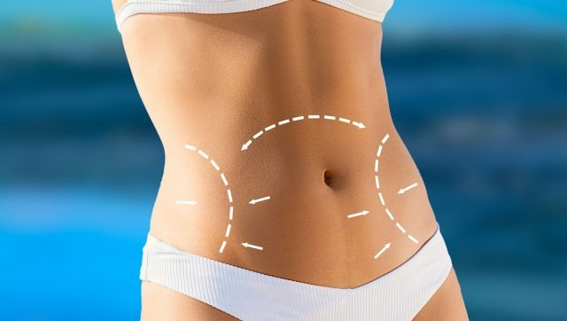 Is Liposuction Covered by Insurance in Islamabad?