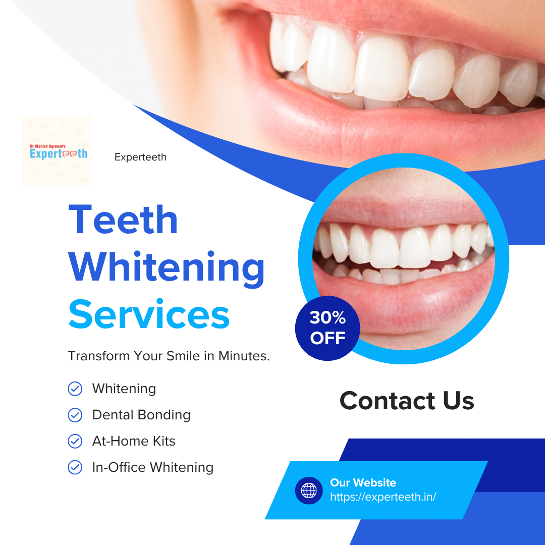 Experteeth Teeth Whitening in Raipur: Achieve a Brighter, Confident Smile