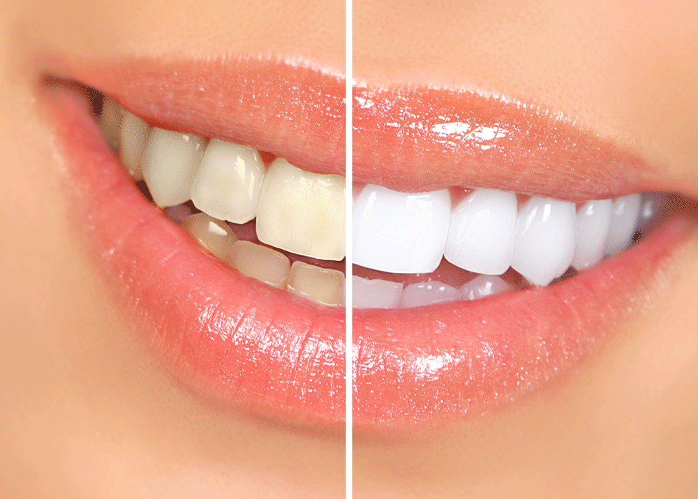 How Can I Find a Reputable Dental Clinic in Lahore for My Dental Needs?