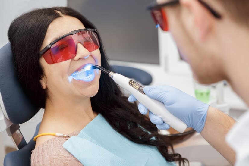 What to Know Before Whitening Your Teeth