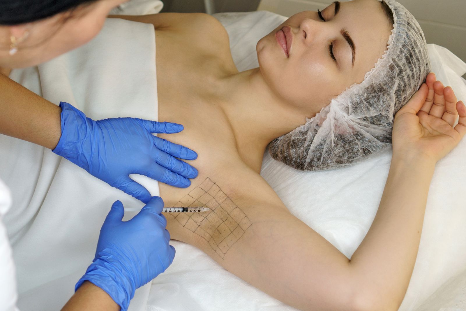 Can Teens Get Under Arms Botox for Sweating?