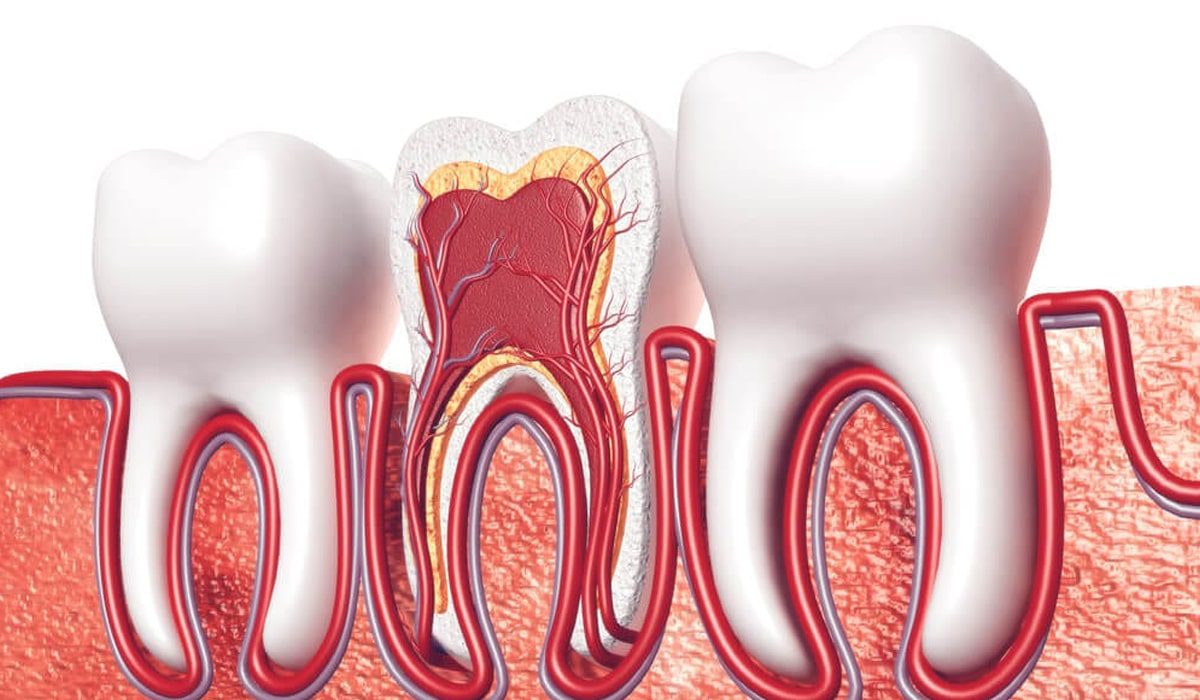 Why Aye Dental Is a Trusted Choice for Root Canal Treatment in Chula Vista