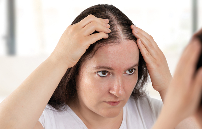 How PCOS Affects Skin and Hair—and How to Treat It