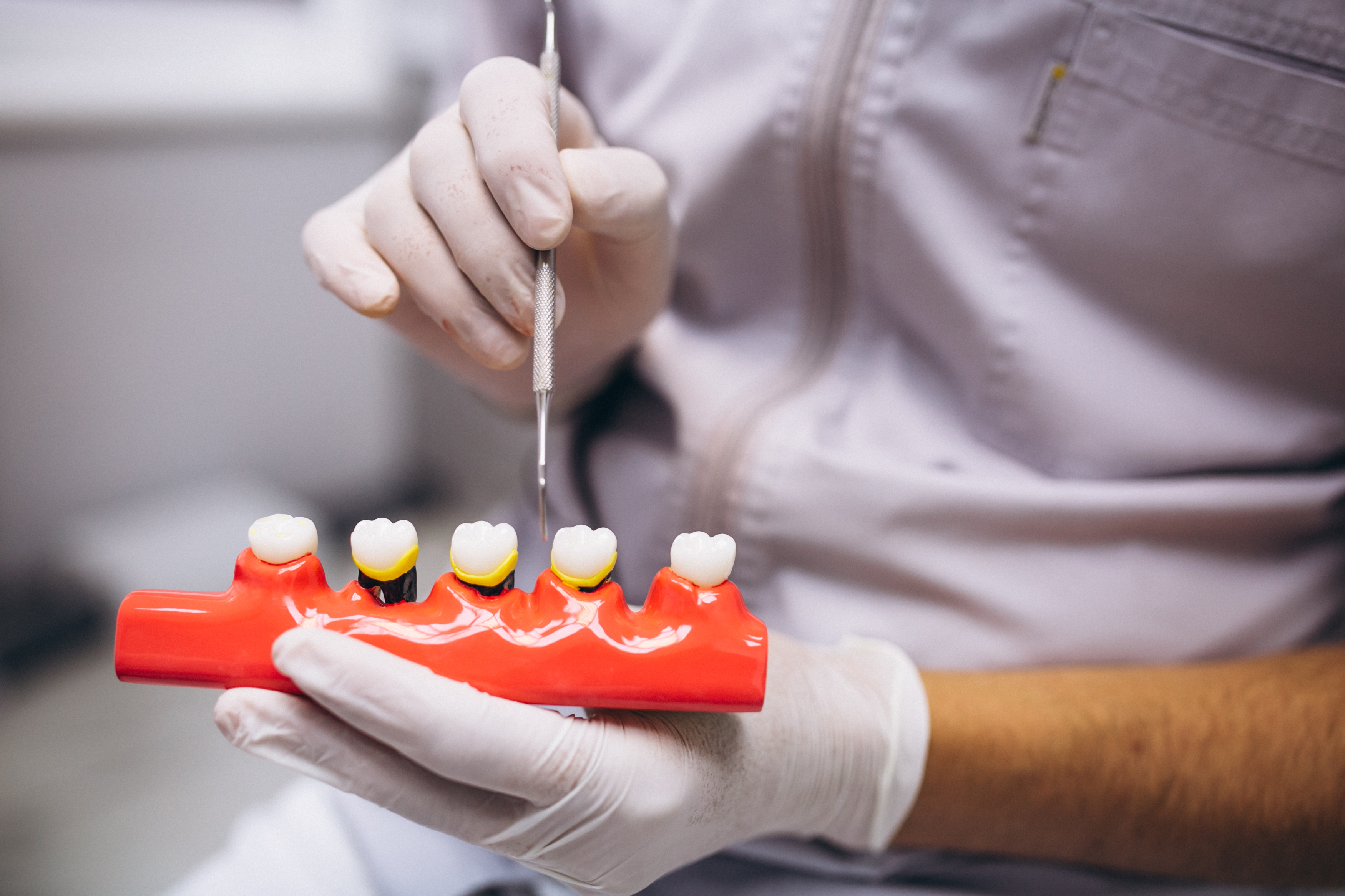 Dental Bridges: Restoring Your Smile with Confidence