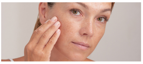 Pigmentation Treatment in Andheri: Say Goodbye to Dark Spots & Uneven Skin Tone Naturally