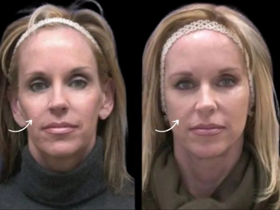 Ethical Advertising: How Best Doctors in Dubai Responsibly Market Sculptra Fillers