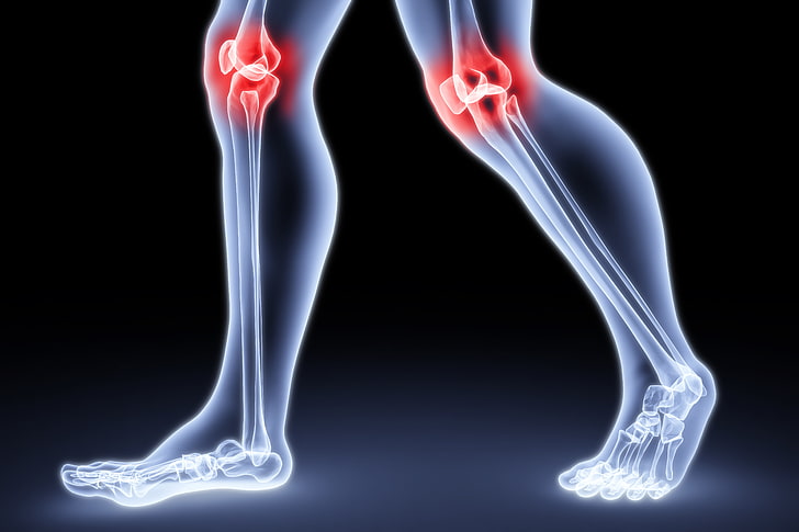 What Causes Joint Inflammation and How to Manage It?