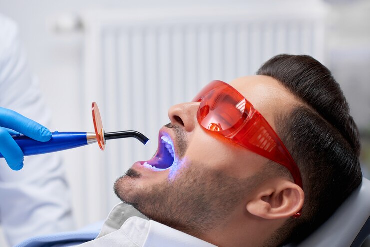Teeth Whitening Options to Brighten Your Smile