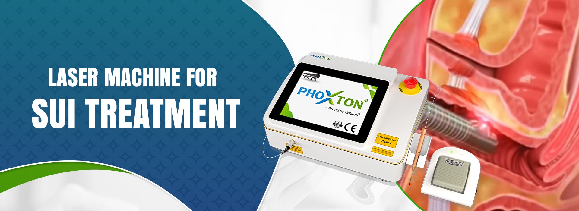Top Laser Machine for SUI Treatment from Phoxton