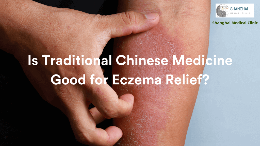 Best Chinese Medicine Therapy for Eczema