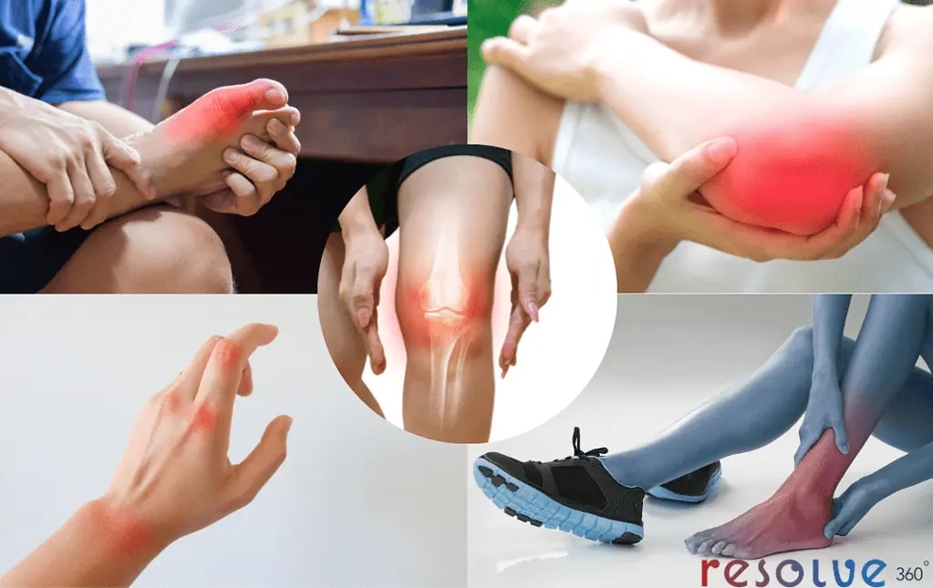 Say Goodbye to Joint Pain with Expert Physiotherapy Techniques