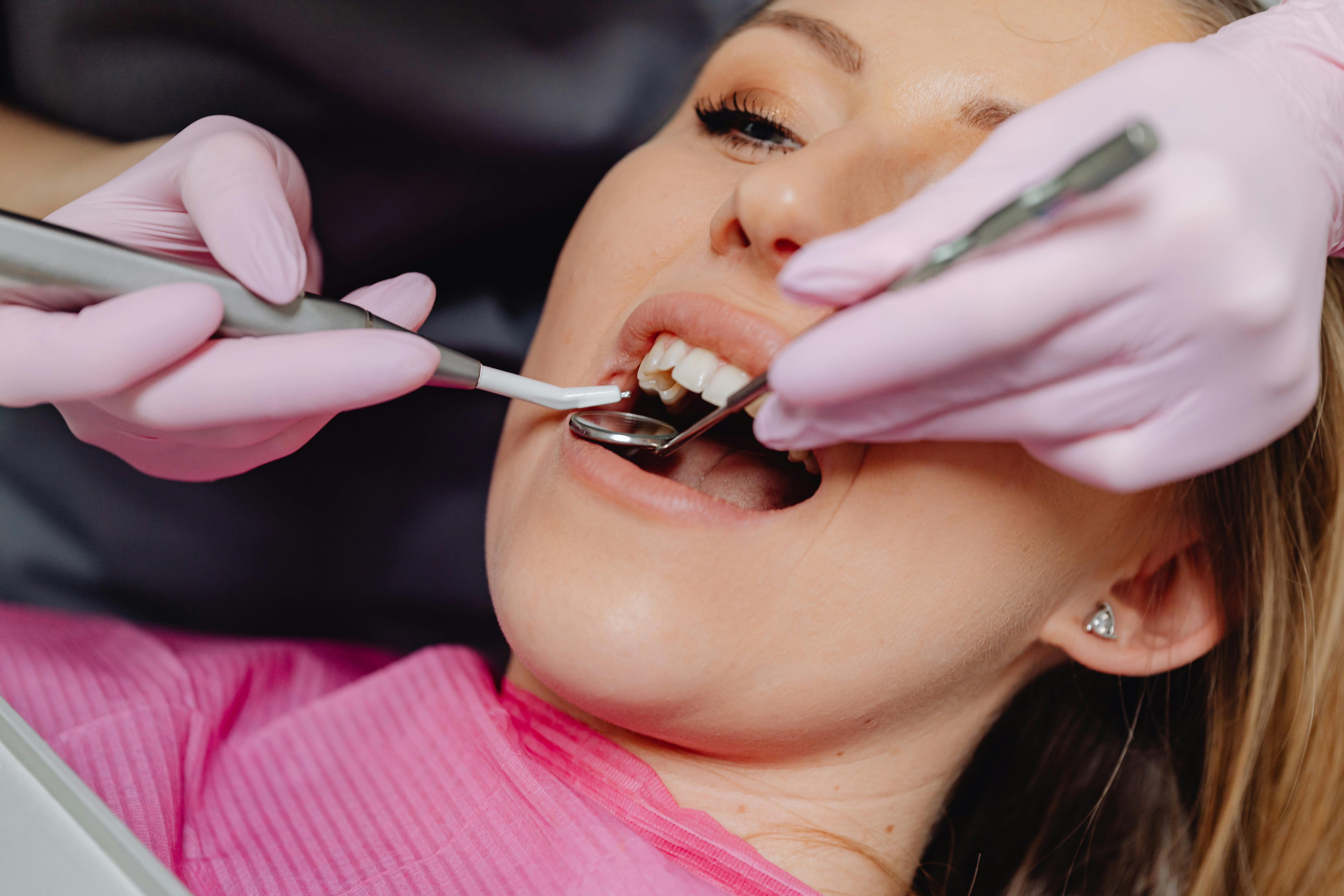 Cheapest All-on-4 Dental Implants in Sydney: A Budget-Friendly Guide to Full-Arch Restoration