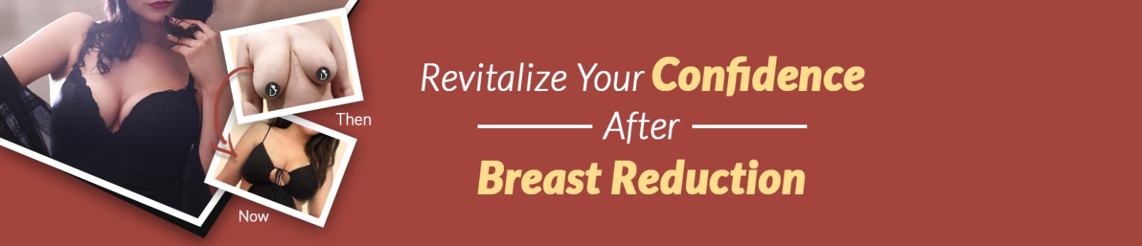Breast Reduction Surgery in Gurgaon – Natural Results with Expert Care