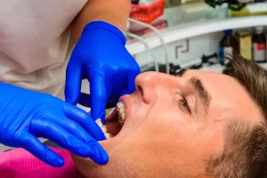 Dental Implants in Sydney: A Complete Guide to Restoring Your Smile