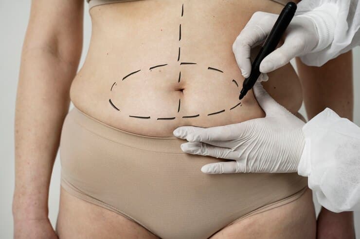 How to Prepare for a Body Contouring Session in Edinburgh